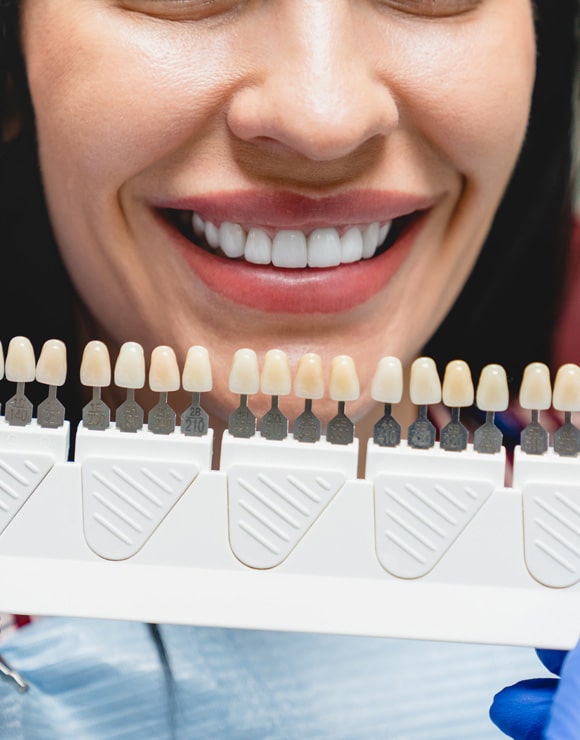 dental implant restorations