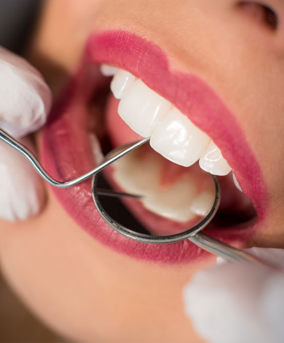 Teeth Cosmetic-services