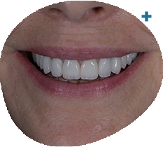 https://innovativedentalaesthetics.com/wp-content/uploads/2025/05/1.png
