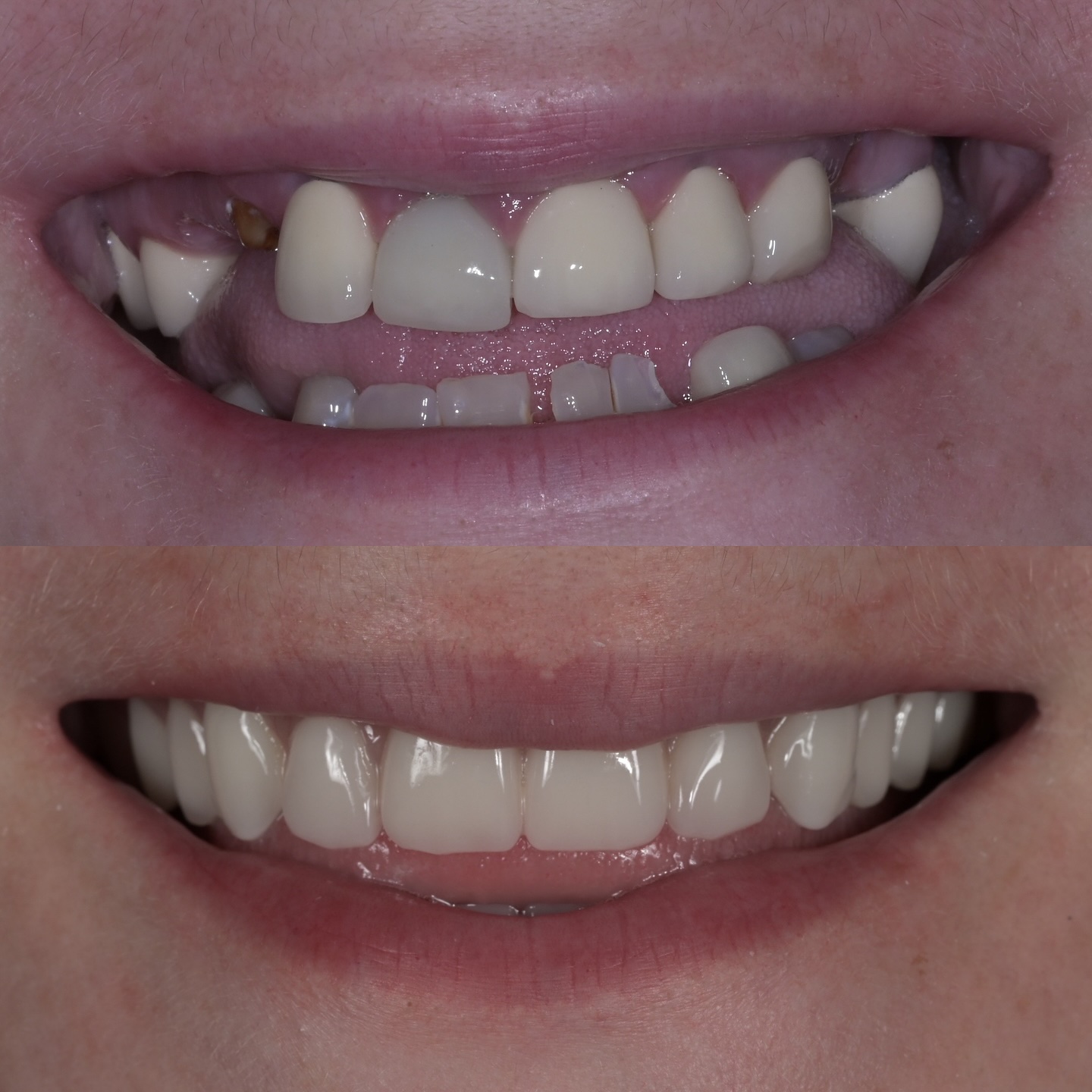 https://innovativedentalaesthetics.com/wp-content/uploads/2025/05/2.jpg