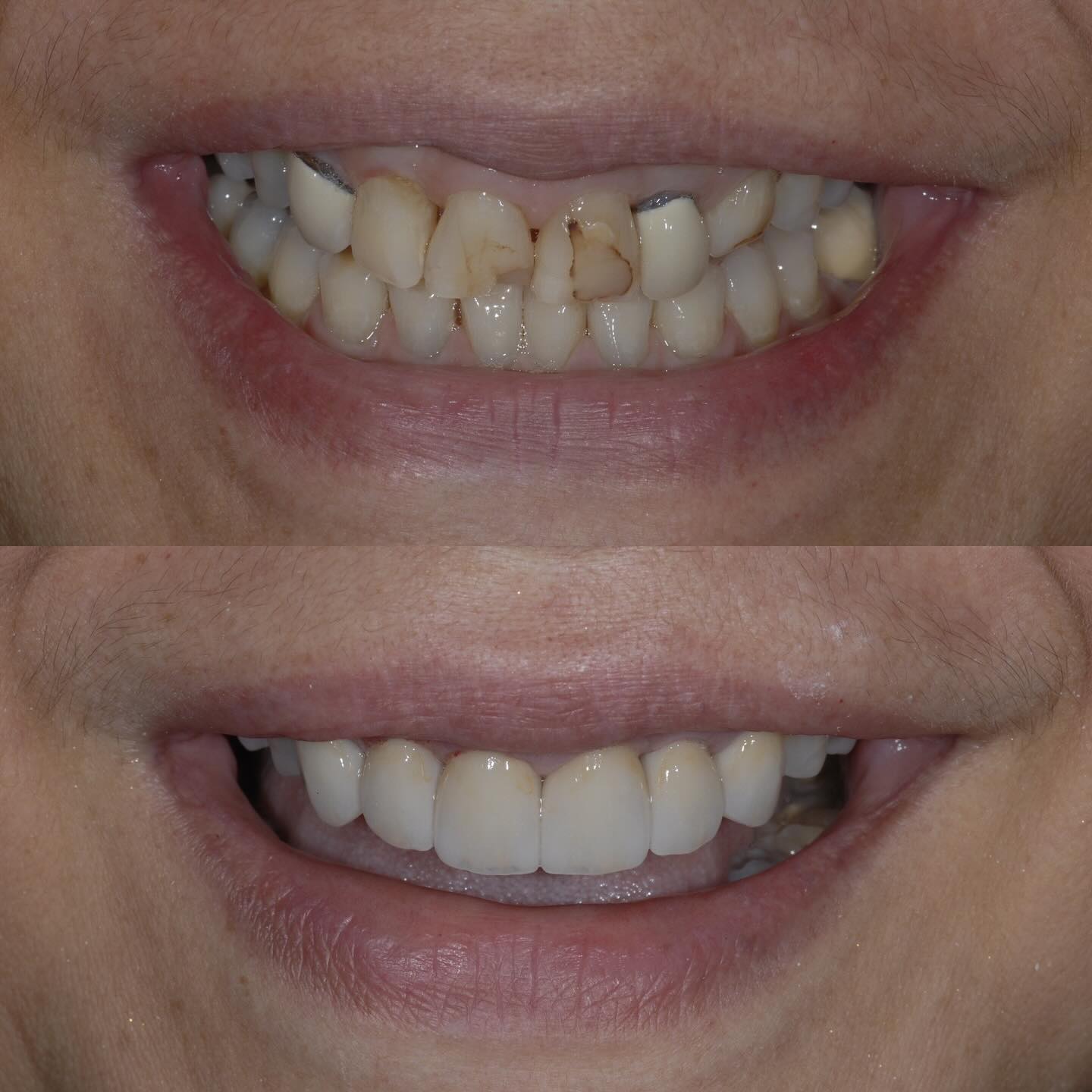 https://innovativedentalaesthetics.com/wp-content/uploads/2025/05/3.jpg