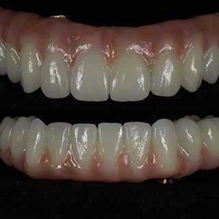 https://innovativedentalaesthetics.com/wp-content/uploads/2025/05/Dental-Implants-1.jpg