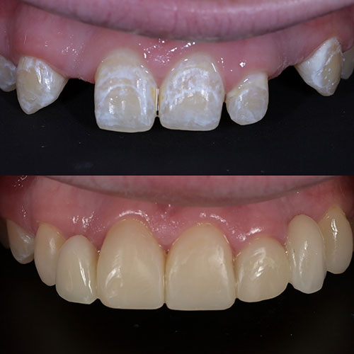 https://innovativedentalaesthetics.com/wp-content/uploads/2025/05/Dental-Implants.jpg