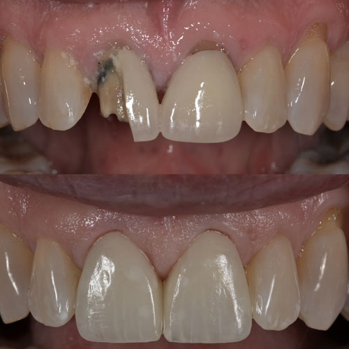 https://innovativedentalaesthetics.com/wp-content/uploads/2025/05/General-Dentistry.jpg