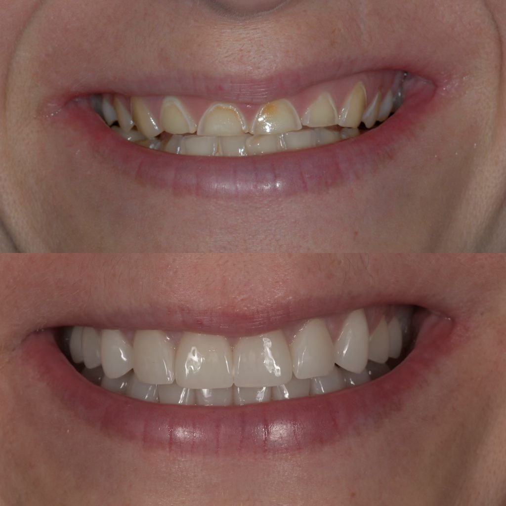 https://innovativedentalaesthetics.com/wp-content/uploads/2025/08/Image3.jpeg