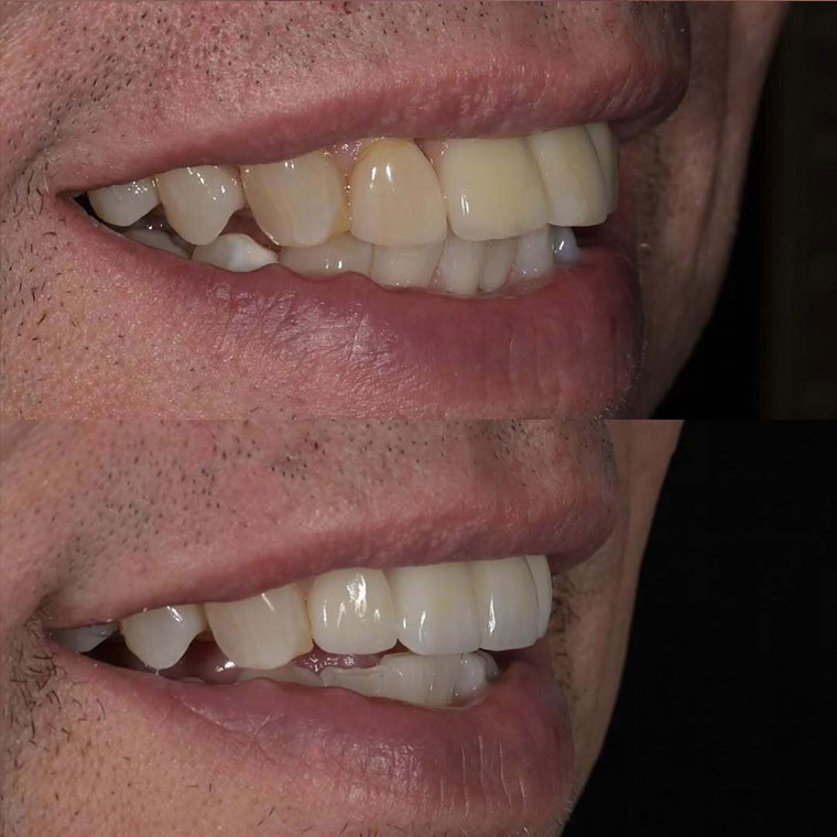https://innovativedentalaesthetics.com/wp-content/uploads/2025/11/b-f.jpg