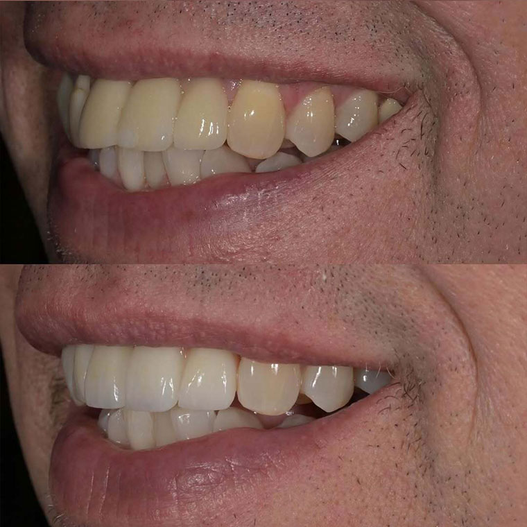 https://innovativedentalaesthetics.com/wp-content/uploads/2025/11/b-f4.jpg