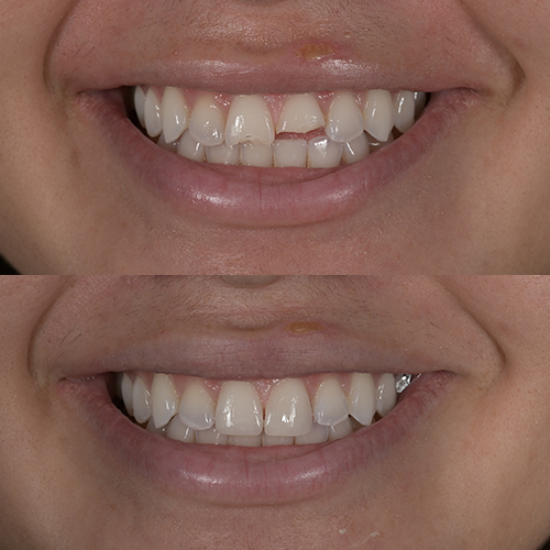 https://innovativedentalaesthetics.com/wp-content/uploads/2025/12/Restorative-Dentistry.jpg
