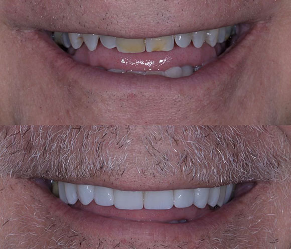 https://innovativedentalaesthetics.com/wp-content/uploads/2026/03/res.jpg