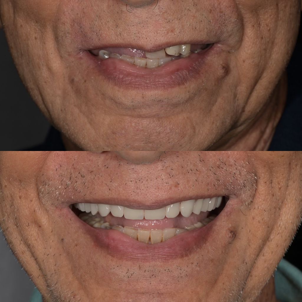 https://innovativedentalaesthetics.com/wp-content/uploads/2026/04/Image7.jpeg
